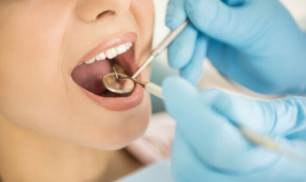 Kiểm tra răng định kỳ