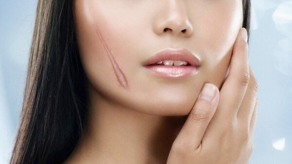 Duy trì chế độ ăn uống, sinh hoạt phù hợp để tránh sẹo thâm
